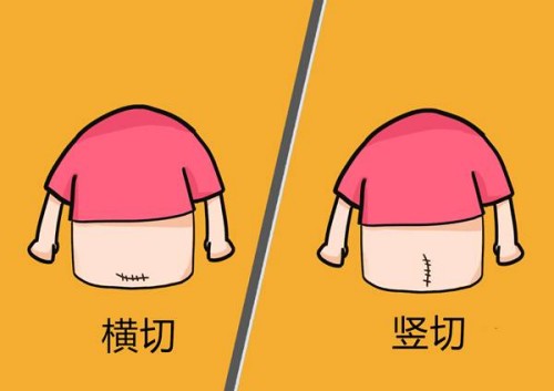 子宫高级病变的临床症状解析，腹胀、阴道出血均在其中