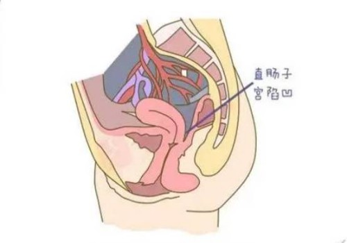 谁说孕妇不能吃香菜？附孕妇吃香菜的好处和注意事项